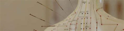 The Top 5 Acupuncturists in Perth [2024] .